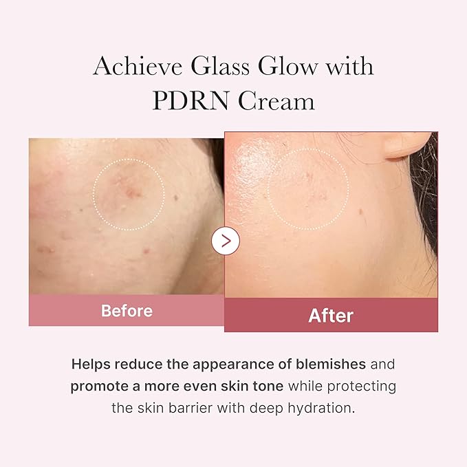 PDRN Pink Hyaluronic Moisturizing Cream (50ml)
