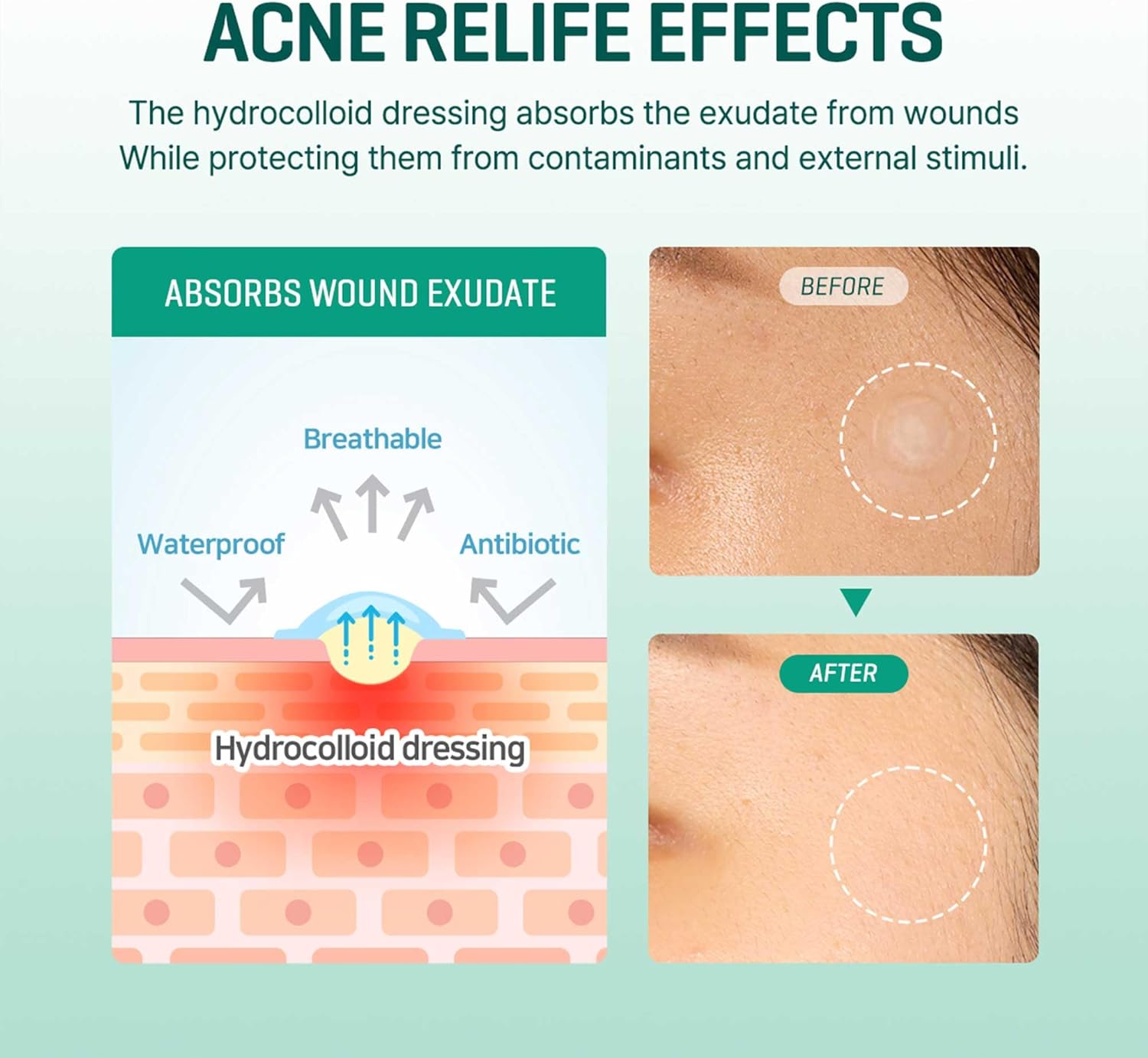 30 Days Miracle Clear Spot Patch (18pcs)