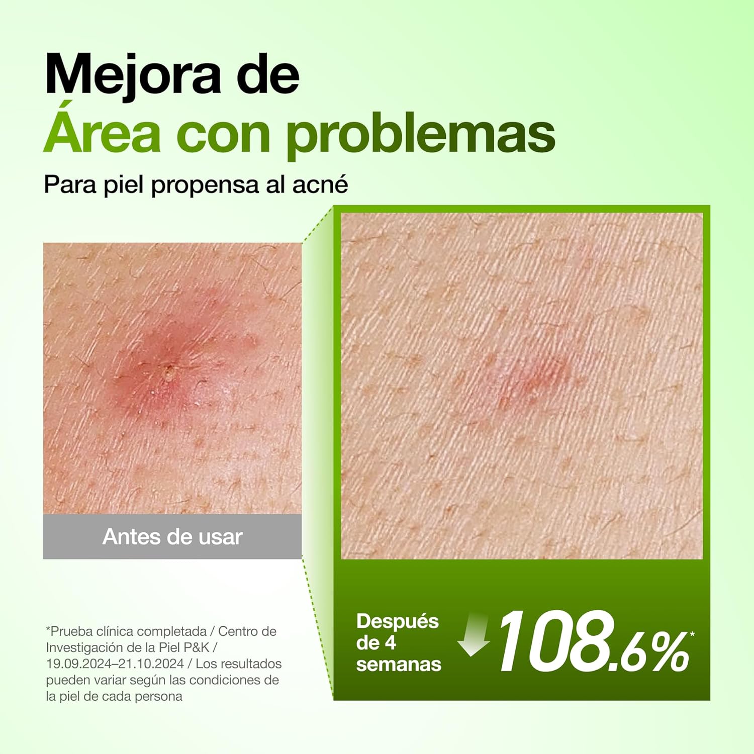 Azelaic Acid 10 Hyaluron Redness Soothing Serum (30ml)