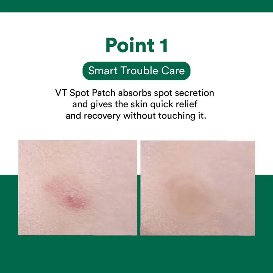 Cica Spot Patch (48pcs)